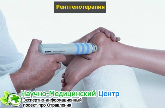 Рентгеновское излучение: воздействие на человека, польза и вред, применение